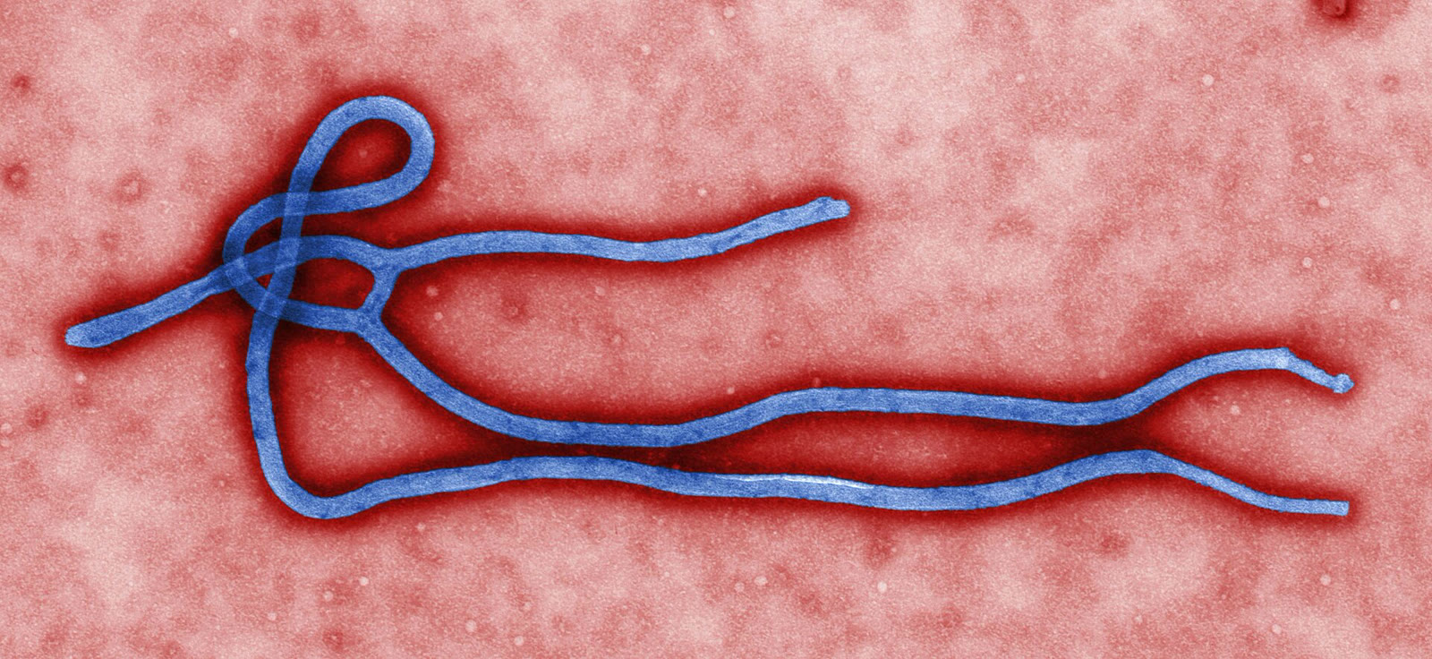 Ebola virüsünün renklendirilmiş elektron mikroskobu görüntüsü (arşiv)